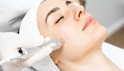 JetPeel-Behandlungen